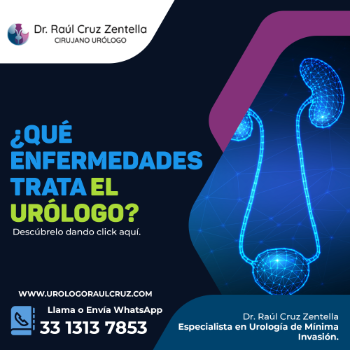 Que atiende el urologo en Guadalajara Zapopan